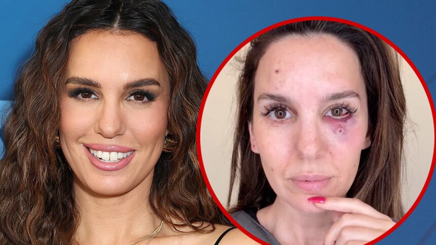 Christy Carlson Romano dice che le sono state colpite in faccia mentre sparavano piccioni di argilla