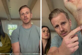 'Bachelor' Sean Lowe ha attaccato 3 volte da Rescue Dog, 'Blood Everywhere' '