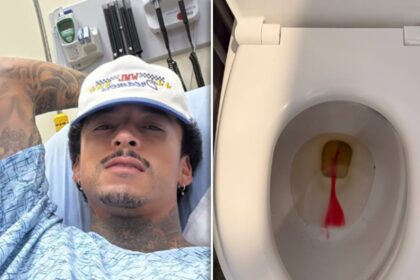 Skateboarder Nyjah Huston fa pipì di sangue dopo l'autunno, "Non ho fratturato il mio cazzo!"