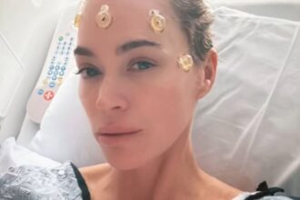 Teddi Mellencamp descrive in dettaglio la perdita di capelli tra il trattamento del cancro