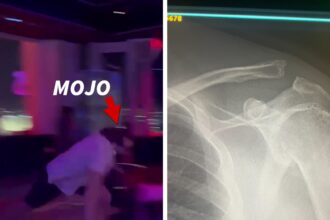 Mojo Muhtadi subisce un infortunio alle spalle nodoso nella battaglia di danza di Las Vegas, in video