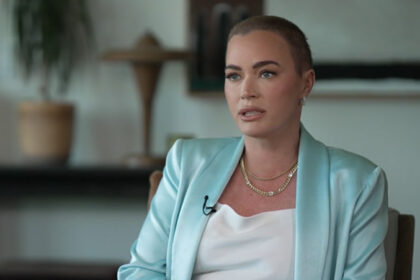 Teddi Mellencamp ha detto che ha una possibilità '50/50 'di sopravvivere al cancro