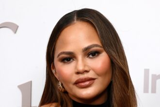 Chrissy Teigen rivela la foto dalla procedura di abbassamento dell'attaccatura