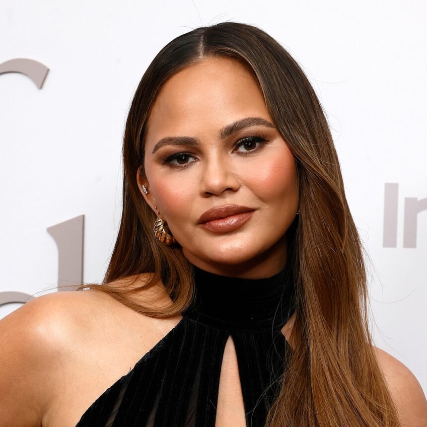 Chrissy Teigen rivela la foto dalla procedura di abbassamento dell'attaccatura