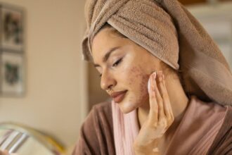 Perché ottieni l'acne sugli aerei e cosa raccomandano i dermatologi