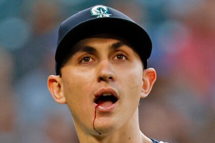 La star MLB George Kirby ha colpito in bocca con una linea di linea 102,7 mph, lascia il gioco insanguinato