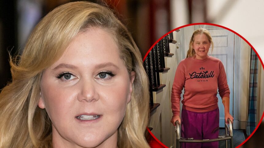 Amy Schumer condivide la foto usando Walker dopo la chirurgia spinale