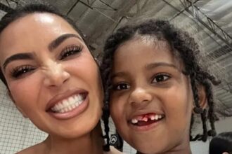 Kim Kardashian post foto del sanguinoso dente anteriore di Saint