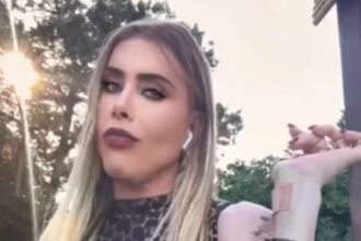 La chirurga dei vip Genny Urtis, ex Giacomo, mostra le ferite riportate dopo il bruttissimo incidente con l'auto in Sardegna: ''Fate attenzione'' - Gossip.it