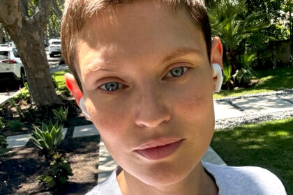 ''Ho aperto Google e ho digitato: il cancro ovarico al terzo stadio è curabile?'': Bianca Balti a un anno dalla scoperta del tumore fa nuove confessioni - Gossip.it