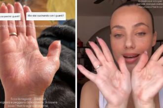 Rosalinda Cannavò mostra le mani sofferenti e svela il problema di salute che la obbliga a indossare guanti - Gossip.it