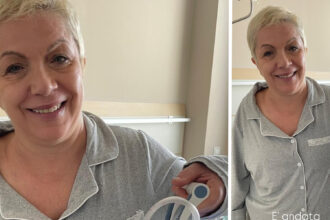 Rosanna Banfi, tumore tornato dopo 16 anni: ''Ha scelto un’altra stanza della mia casa''. Foto dopo l’intervento - Gossip.it