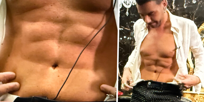 Federico Fashion Style a Le Iene mostra il risultato della sua addominoplastica: ''Mi ha cambiato la vita'' - Gossip.it