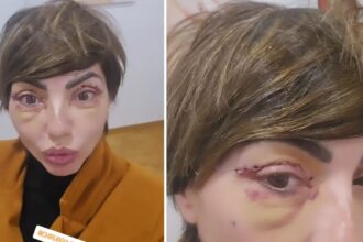 ''Ho tolto i punti'': l’ex Non è la Rai Ilaria Galassi si è sottoposta a un intervento di chirurgia estetica, ecco quale - Gossip.it