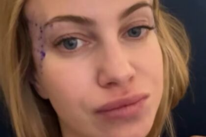 ''Non ve lo dirò mai'': Taylor Mega in clinica per un intervento ‘misterioso’ ne approfitta e mette un po’ di grasso in una parte del corpo - Gossip.it