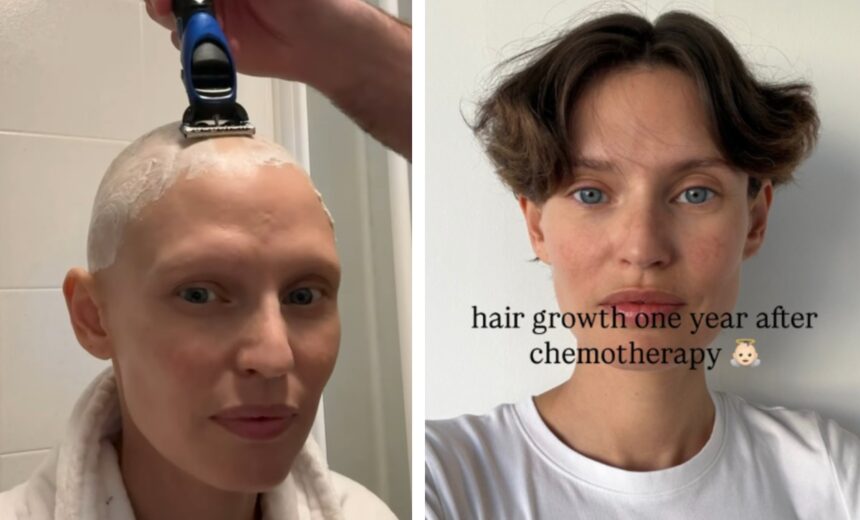''Un anno fa l’ultima chemio'': Bianca Balti pubblica le foto di quando era calva, i suoi capelli ora ricrescono in fretta, guarda - Gossip.it