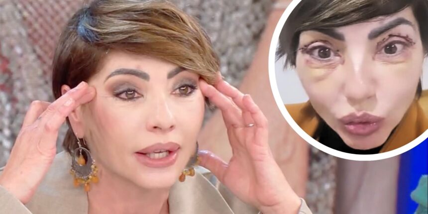 ''Guardate i miei occhi, sono bellissima'': Ilaria Galassi di 'Non è la Rai' si mostra soddisfatta in tv dopo l’intervento estetico - Gossip.it