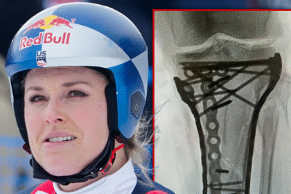 Lindsey Vonn "lotta" dopo l'ultimo intervento chirurgico, rimane ricoverata in ospedale negli Stati Uniti