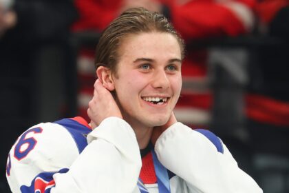 Jack Hughes ha perso un dente alle Olimpiadi? Come ha perso i denti anteriori - Vita a Hollywood