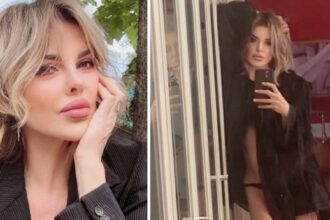 ''Ho imparato a conviverci'': Alba Parietti parla dei suoi ritocchini e svela cosa è andato ‘storto’ col chirurgo estetico - Gossip.it