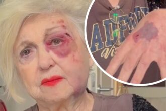 Ecchimosi e graffi: Wanna Marchi si mostra sul social ''devastata'', ecco cos’è successo - Gossip.it