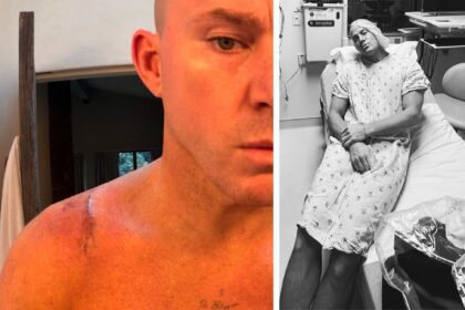 ''Colpa mia per non aver chiesto'': l’attore Channing Tatum sorpreso dalla grandezza della cicatrice del suo recente intervento, foto - Gossip.it