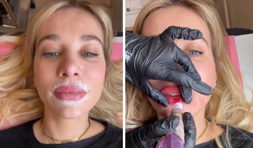 ''Risultato pazzesco!'': Clizia Incorvaia rivela il segreto delle sue labbra perfette - Gossip.it