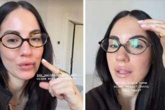 ''Non vedo l’ora che si attivi'': Giulia De Lellis svela di aver rifatto il Botox dopo circa un anno, guarda - Gossip.it