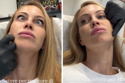 ''18.30 vengo a farmi il Botox'': Taylor Mega va da chirurgo estetico per un ritocchino salvifico, ecco quale - Gossip.it