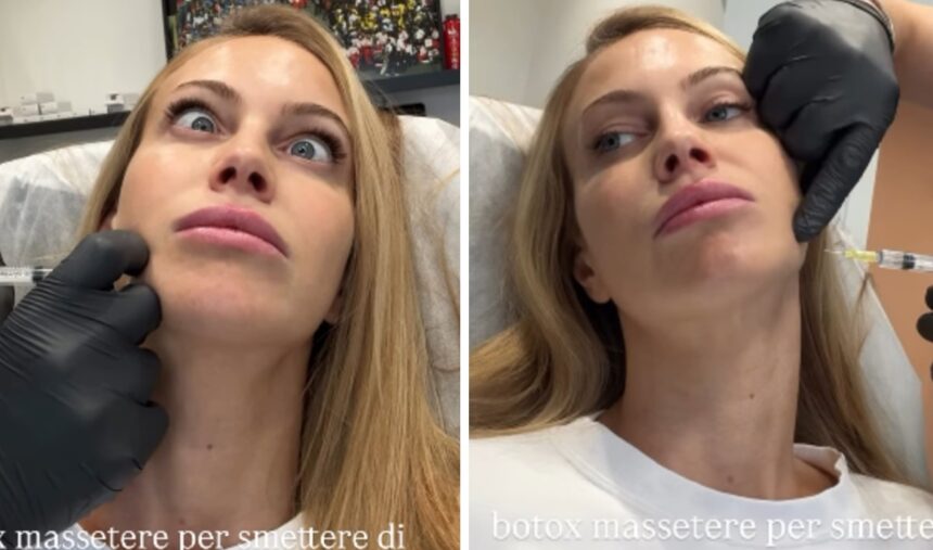 ''18.30 vengo a farmi il Botox'': Taylor Mega va da chirurgo estetico per un ritocchino salvifico, ecco quale - Gossip.it