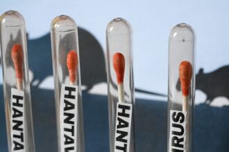 L'Hantavirus è negli Stati Uniti? Aggiornamento nel caos delle navi da crociera del 2026: vita a Hollywood