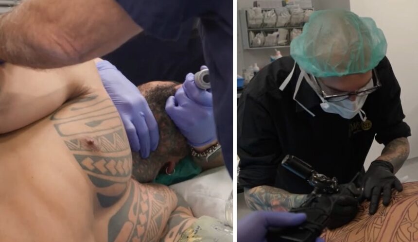 ''Il primo in Italia'': Francesco Chiofalo in tv mostra la sua operazione per il tatuaggio istantaneo e svela il disegno scelto, guarda - Gossip.it