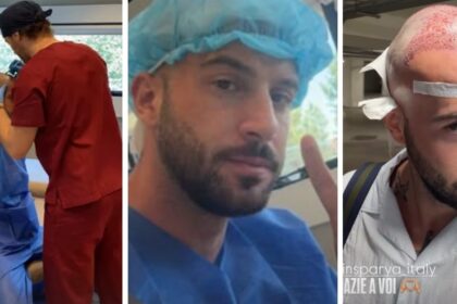 ''Non si torna più indietro!'': Andreas Muller ha deciso di risolvere il suo ‘problemino’ e si è sottoposto a un trapianto di capelli, guarda - Gossip.it