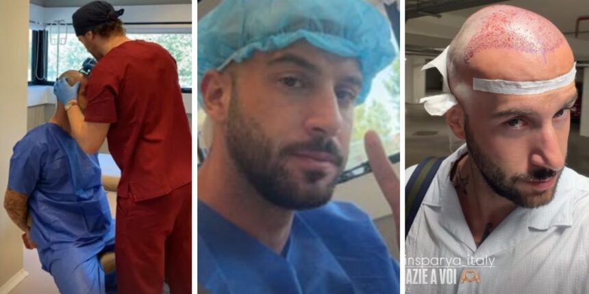 ''Non si torna più indietro!'': Andreas Muller ha deciso di risolvere il suo ‘problemino’ e si è sottoposto a un trapianto di capelli, guarda - Gossip.it