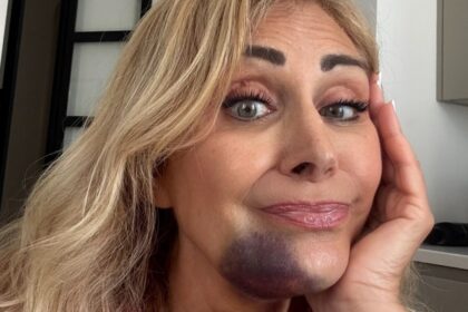 “Poteva andare molto peggio”: Marina Di Guardo, mamma di Chiara Ferragni, rivela di aver avuto un incidente stradale e svela i danni fisici riportati - Gossip.it