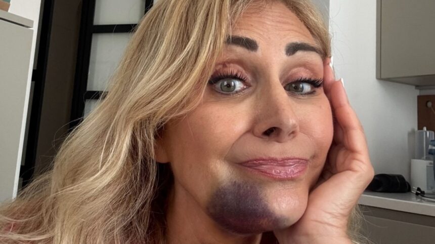 “Poteva andare molto peggio”: Marina Di Guardo, mamma di Chiara Ferragni, rivela di aver avuto un incidente stradale e svela i danni fisici riportati - Gossip.it