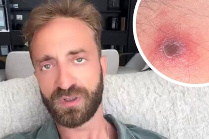“Le cose sono degenerate”: il volto tv Stefano Corti ricoverato con 40 di febbre dopo un’infezione contratta all’estero, il racconto - Gossip.it