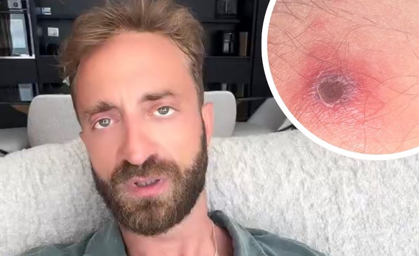 “Le cose sono degenerate”: il volto tv Stefano Corti ricoverato con 40 di febbre dopo un’infezione contratta all’estero, il racconto - Gossip.it