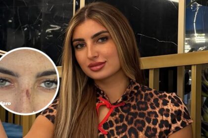 “Alcune donne gelose di me”: Sabrina Soussi di Temptation Island mostra i graffi dopo l’aggressione - Gossip.it