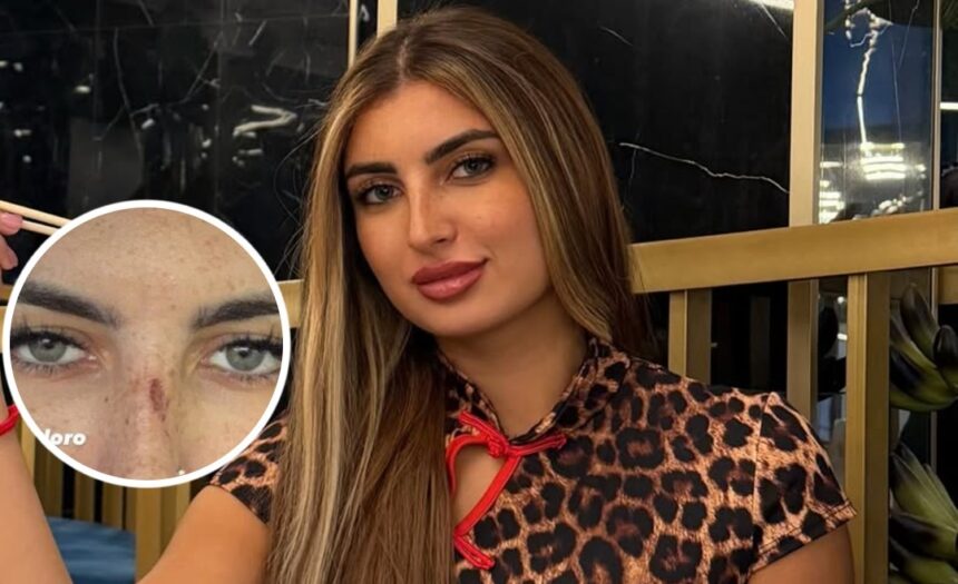 “Alcune donne gelose di me”: Sabrina Soussi di Temptation Island mostra i graffi dopo l’aggressione - Gossip.it