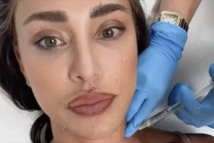 “Non fatelo prima di andare a cena”: Belen Rodriguez  mostra il collo pieno di bozzi e ironizza, guarda  - Gossip.it