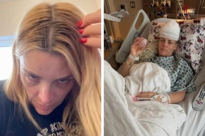 La star di “Dawson’s Creek” Busy Philipps rivela del tumore al cervello scoperto per caso e mostra le foto in terapia intensiva dopo cinque ore di intervento - Gossip.it