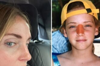 “Ecco perché ora è così”: Chiara Ferragni spiega perché il suo naso è un po’ storto, tutto è accaduto quando aveva solo 10 anni - Gossip.it