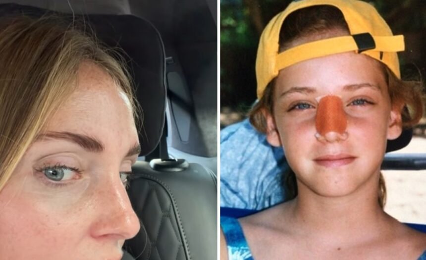 “Ecco perché ora è così”: Chiara Ferragni spiega perché il suo naso è un po’ storto, tutto è accaduto quando aveva solo 10 anni - Gossip.it