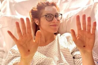 “Molto spaventata”: Noemi dopo essere caduta dal palco ha temuto la rottura della spina dorsale, ecco le fratture riportate - Gossip.it