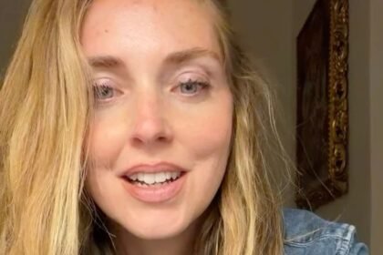 Le scrivono che ha i “denti di sotto storti e brutti da vedere”, Chiara Ferragni spiega perché non li ha modificati anche se ha due familiari dentisti: le sue parole - Gossip.it