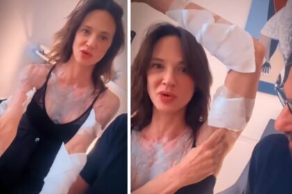 “Errore di gioventù”: Asia Argento rimuove tutti i tatuaggi e si fa vedere piena di cerotti, guarda - Gossip.it