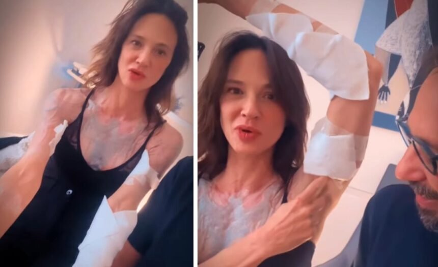 “Errore di gioventù”: Asia Argento rimuove tutti i tatuaggi e si fa vedere piena di cerotti, guarda - Gossip.it