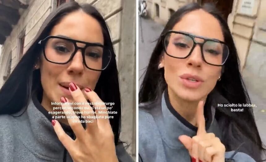 “Ho sciolto le labbra”: Giulia De Lellis svela che dopo tantissimi anni ha fatto la ialuronidasi e spiega perché - Gossip.it