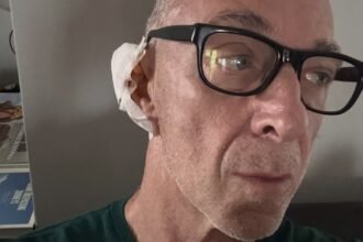 “Speravo di cavarmela con un cerottino e invece…”: Linus svela di avere un tumore della pelle, guarda - Gossip.it